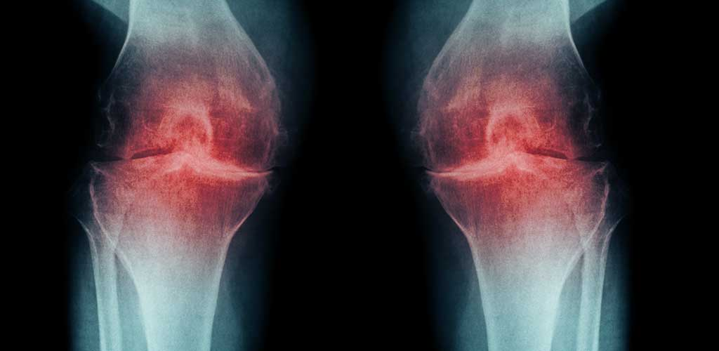 Pain Stole More Than Just His Mobility—It Stole His Life